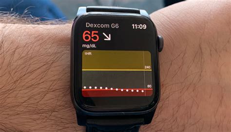 apple watch ands|apple watch and diabetes monitoring.